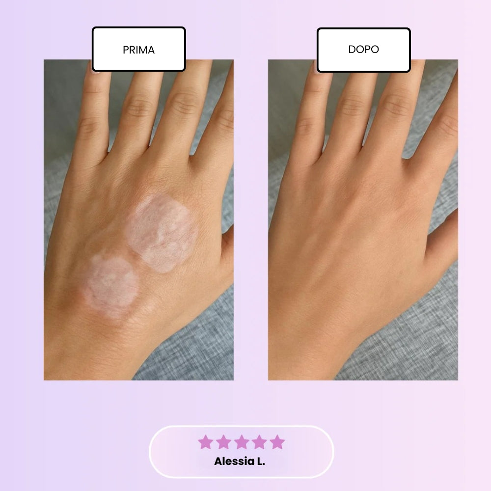 Nastro di Silicone al Collagene