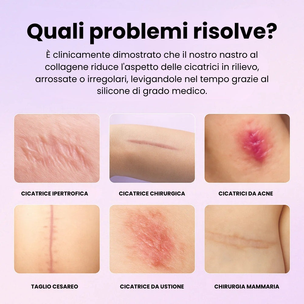 Nastro di Silicone al Collagene